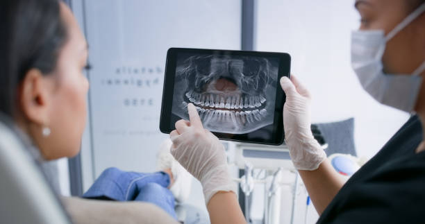 Licensed Root Canal Treatment service in Citrus Springs, FL - Smile Center Dentistry